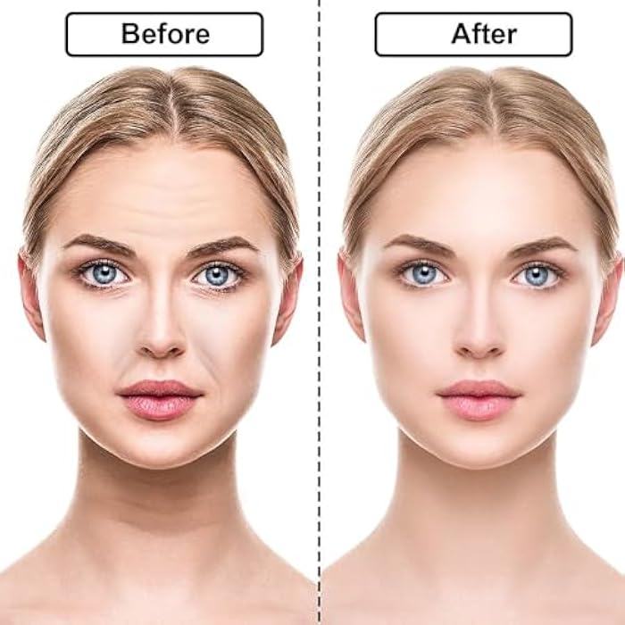 16 Pcs Reusable Anti-Wrinkle Patches – Forehead, Neck & Eye Pads, Wrinkle Removal Stickers for Face, Skin Care & Beauty Health - Image 4